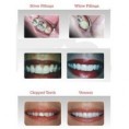 /album/cosmetic-dentistry/cosmatic-dental-3-jpg/